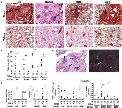 Silica Exposure Differentially Modulates Autoimmunity in Lupus Strains and Autoantibody Transgenic Mice